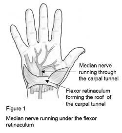 Coastal Orthopaedics Taranaki - Carpal Tunnel Syndrome